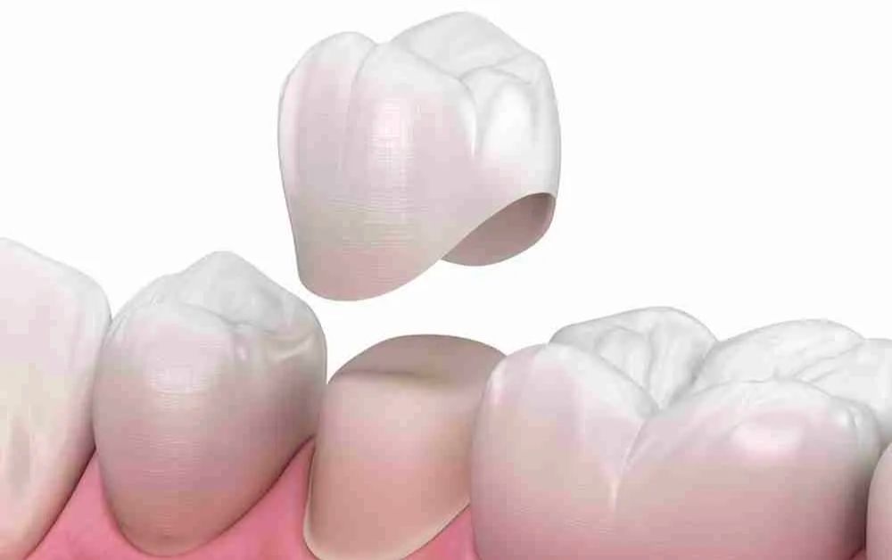 restorative dental care