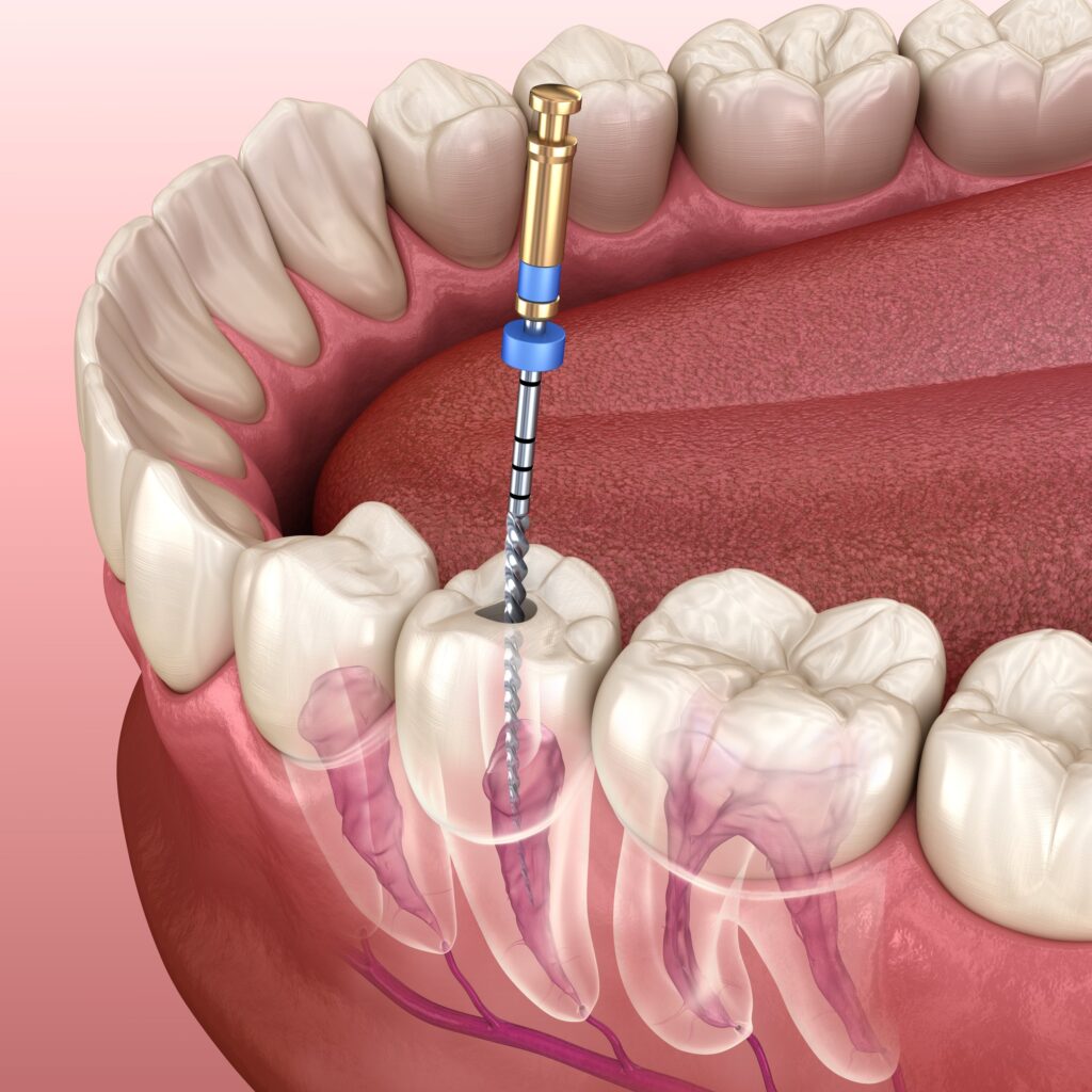 restorative dental care