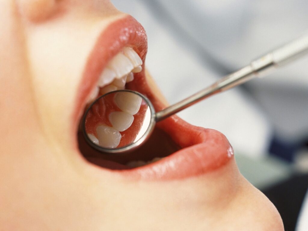 Dental check up at Asquith Dentists